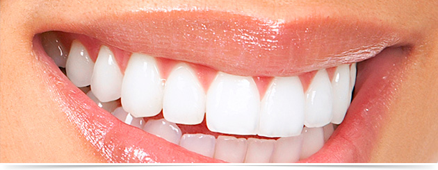 Clareamento Dental - Clínica Sorriso Santana
