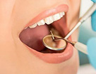 Restaurações Dentárias - Clínica Sorriso Santana